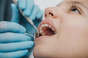 Tratamientos dentales avanzados en Murcia