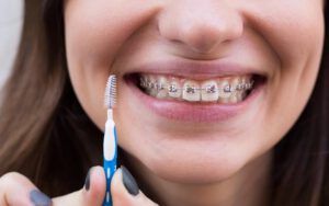 Ortodoncia puede facilitar la higiene bucal diaria